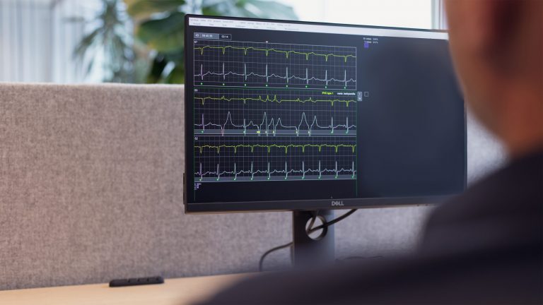 Fysiologic zoekt Supervisor/ Sr. ECG-analisten